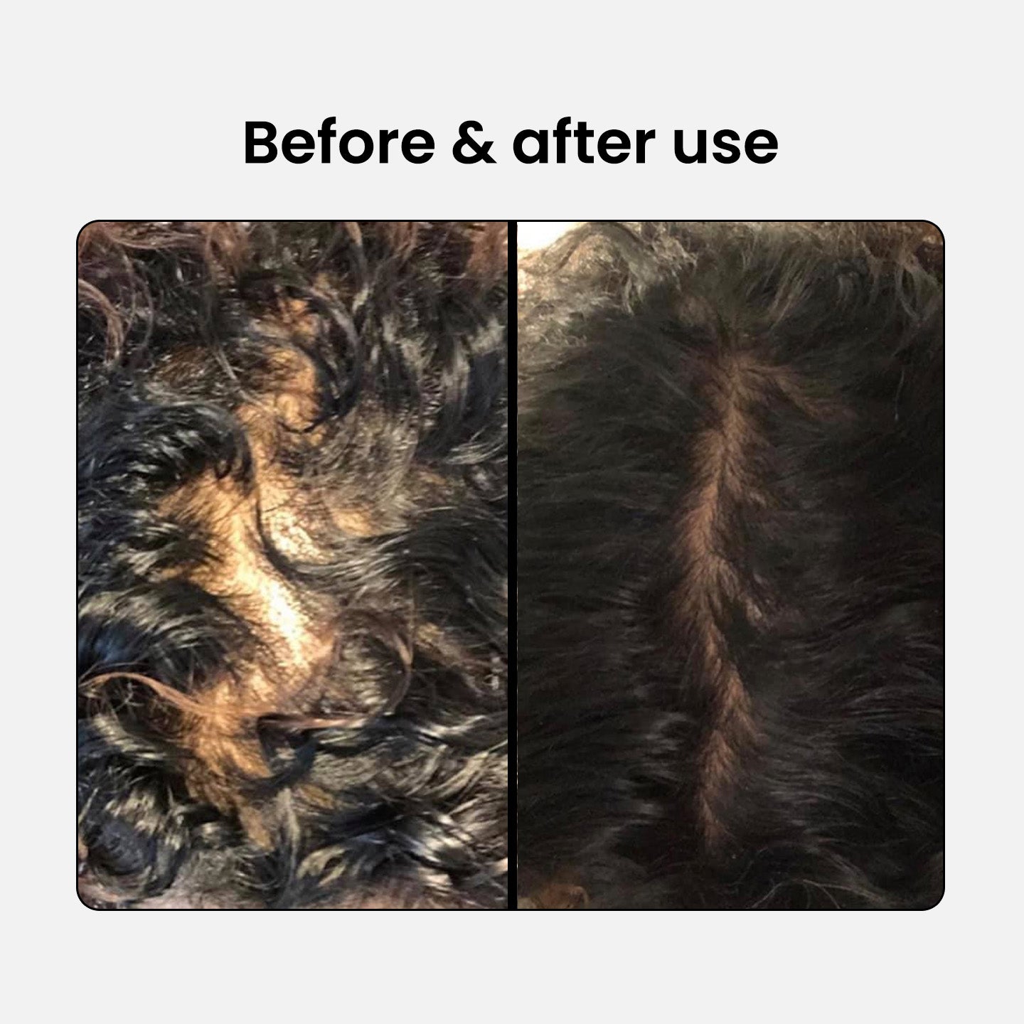 Acondicionador Anticaída del Cabello