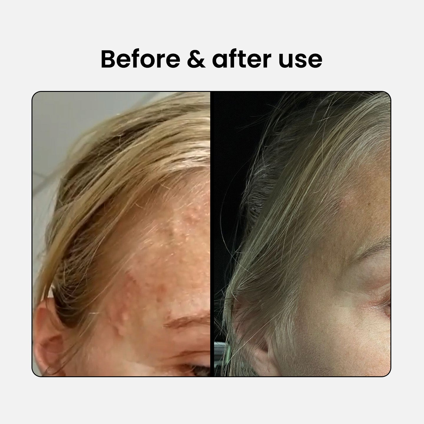 Set BHA: Limpiador + Suero