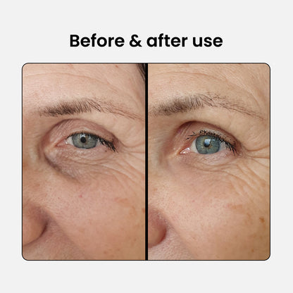 Suero para levantamiento de ojos - 5% cafeína + EGCG