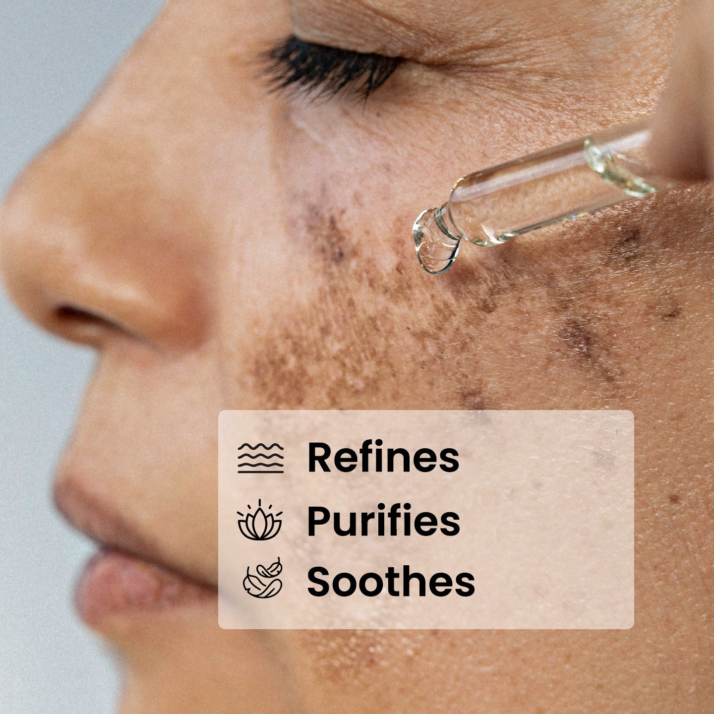 Suero de Niacinamida 10%