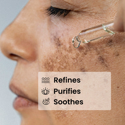 Suero de Niacinamida 10%