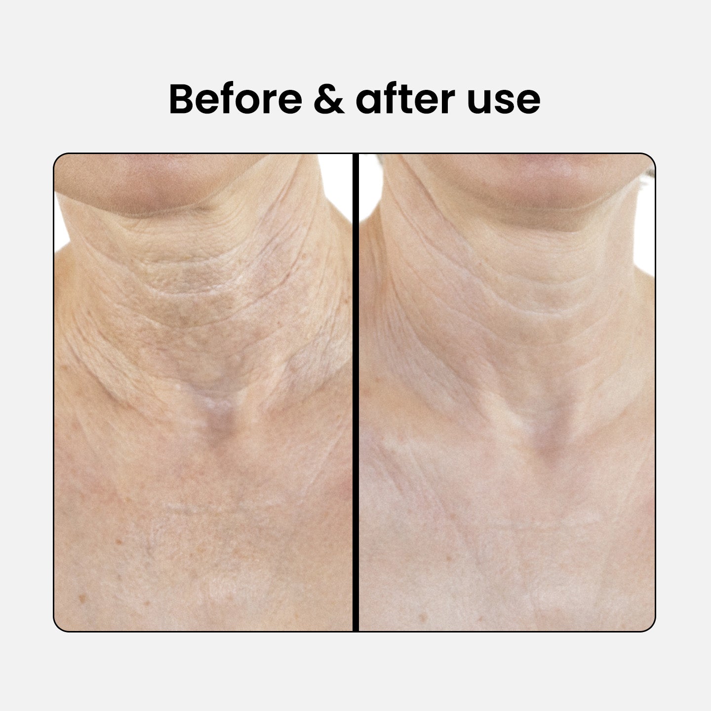 Loción reafirmante para cuello y escote con péptidos