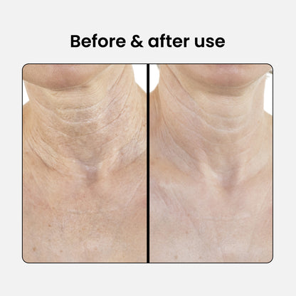 Loción reafirmante para cuello y escote con péptidos